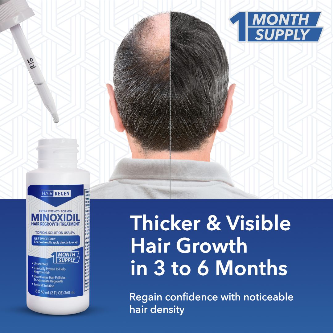 Hair-Regen: 5% Minoxidil Hair Regrowth Treatment for Men