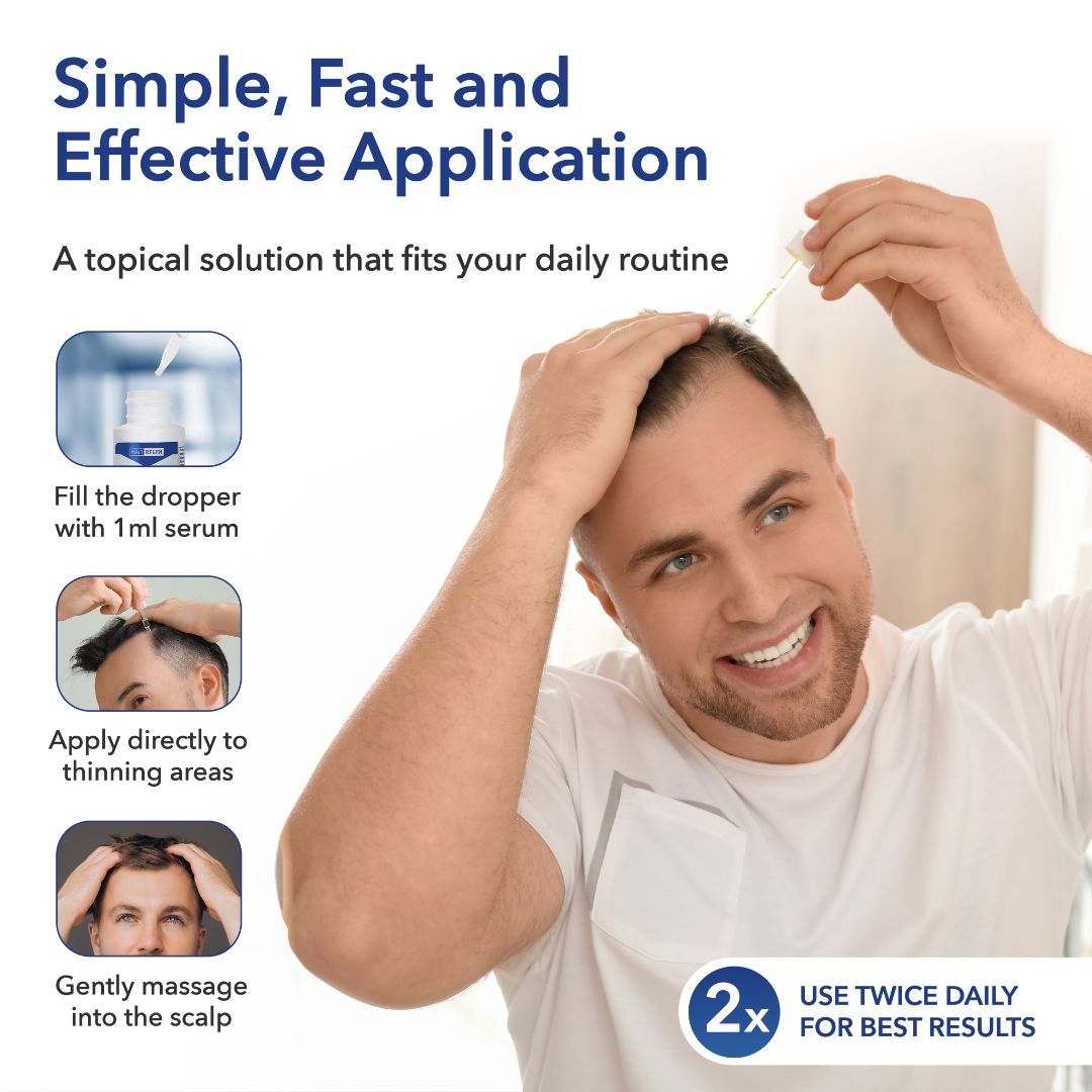 Hair-Regen: 5% Minoxidil Hair Regrowth Treatment for Men