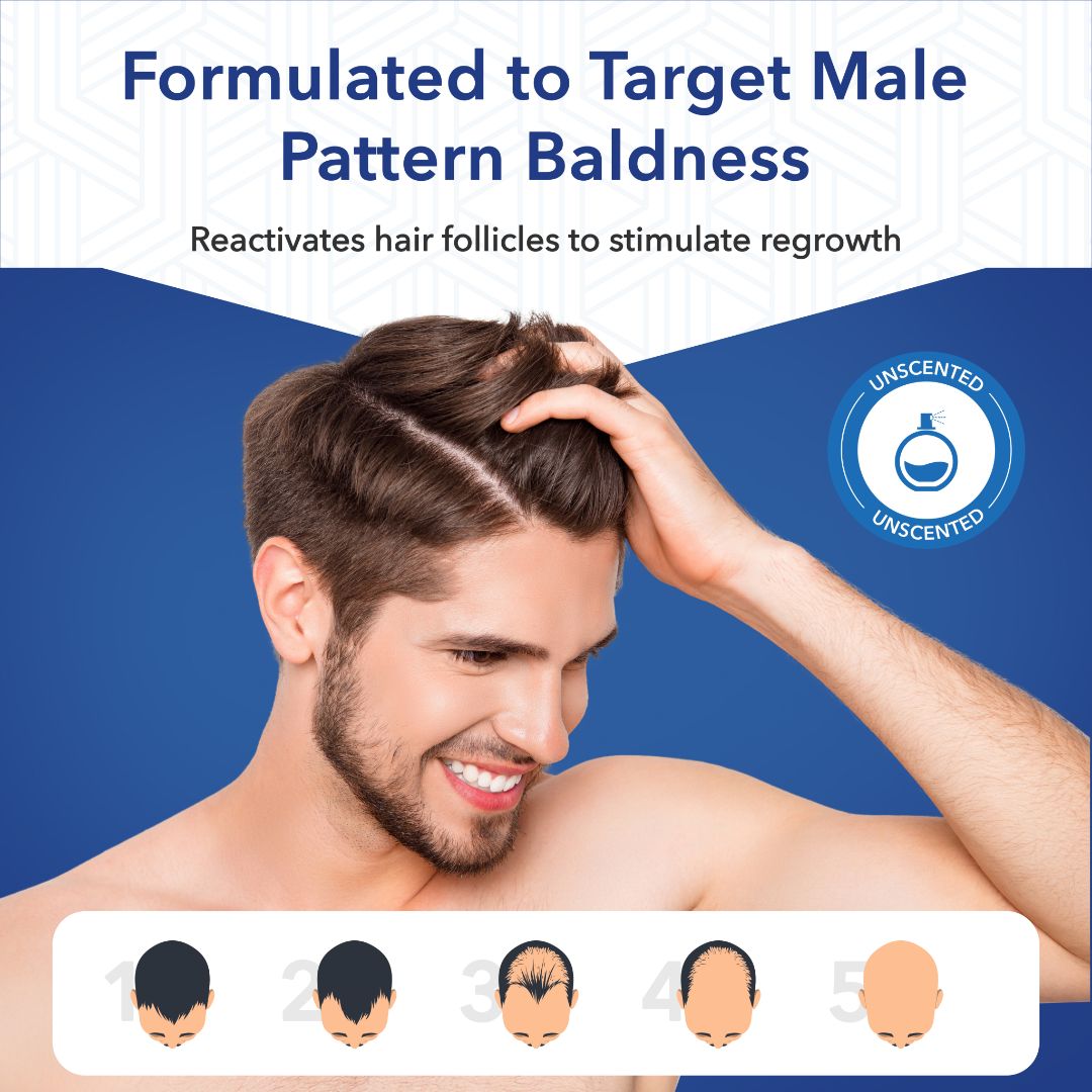 Hair-Regen: 5% Minoxidil Hair Regrowth Treatment for Men