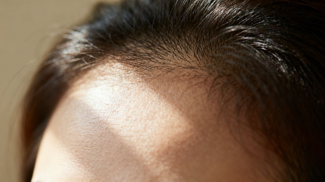 Woman's scalp with thinning hair, close-up view.
