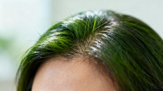 Scalp with healthy hair regrowth after oral minoxidil treatment.