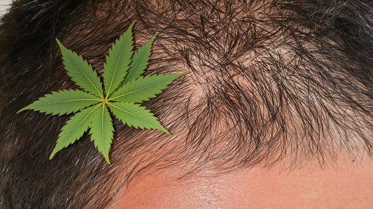 Thinning hair on a scalp with a marijuana leaf.