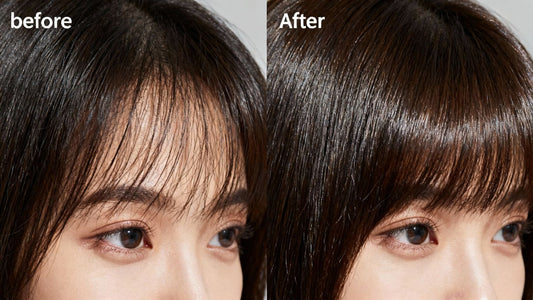 Woman's hair before and after Nutrafol treatment.