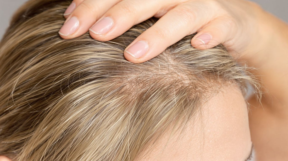 Woman's scalp with visible thinning hair