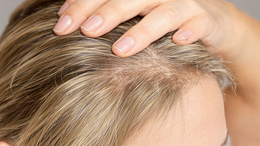 Woman's scalp with visible thinning hair