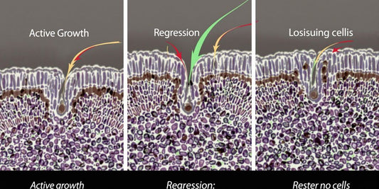 Hair follicle growth phases.
