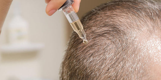 Person applying hair treatment dropper to thinning hairline in bathroom