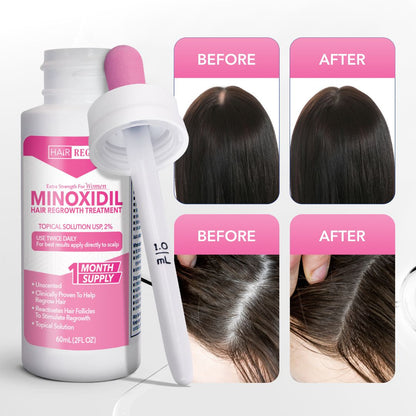 Hair-Regen: 5% Minoxidil Hair Regrowth Treatment for Women